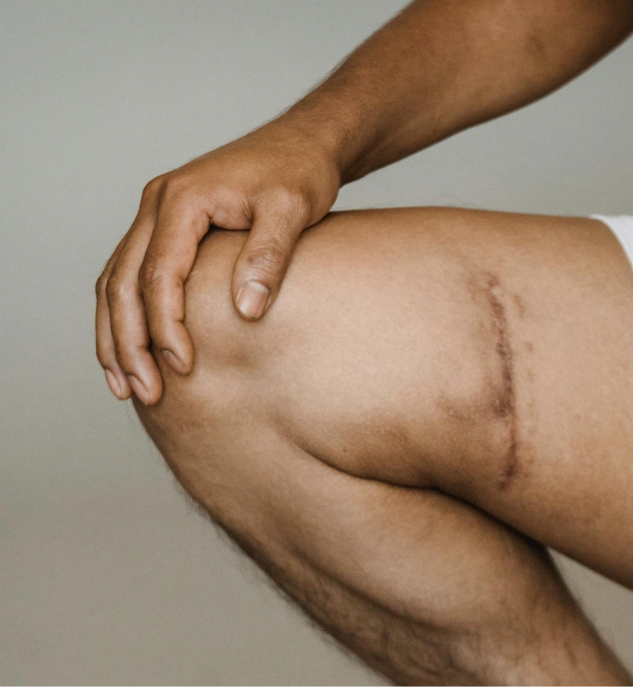 Scar Therapy Massage<br />
